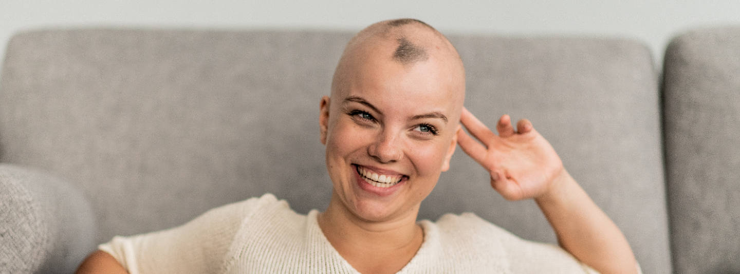 femme atteinte d'alopecie femme atteinte d'alopecie